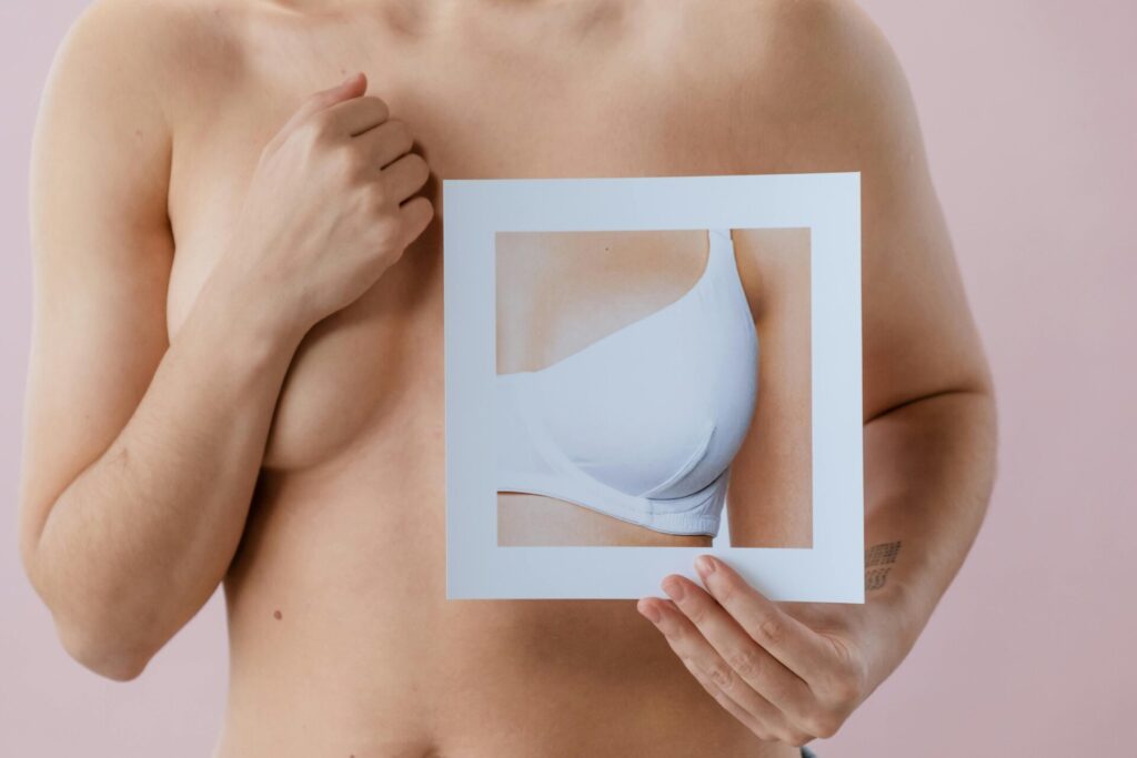 #ultrassonografiamama #ultrassomdamama #USGmamária #DopplerMamário #prevençãodomam #câncerdemama #diagnósticoprecoce #ultrassomcomdoppler #examepreventivo #imagemmamária #ultrassomirece #ireceba #DrTompsonRocha